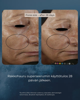 Rakkohauru superseerumi, peptidit, retinoli, hyaluronihappo, maksaläiskät, juonteet, ihohuokoset