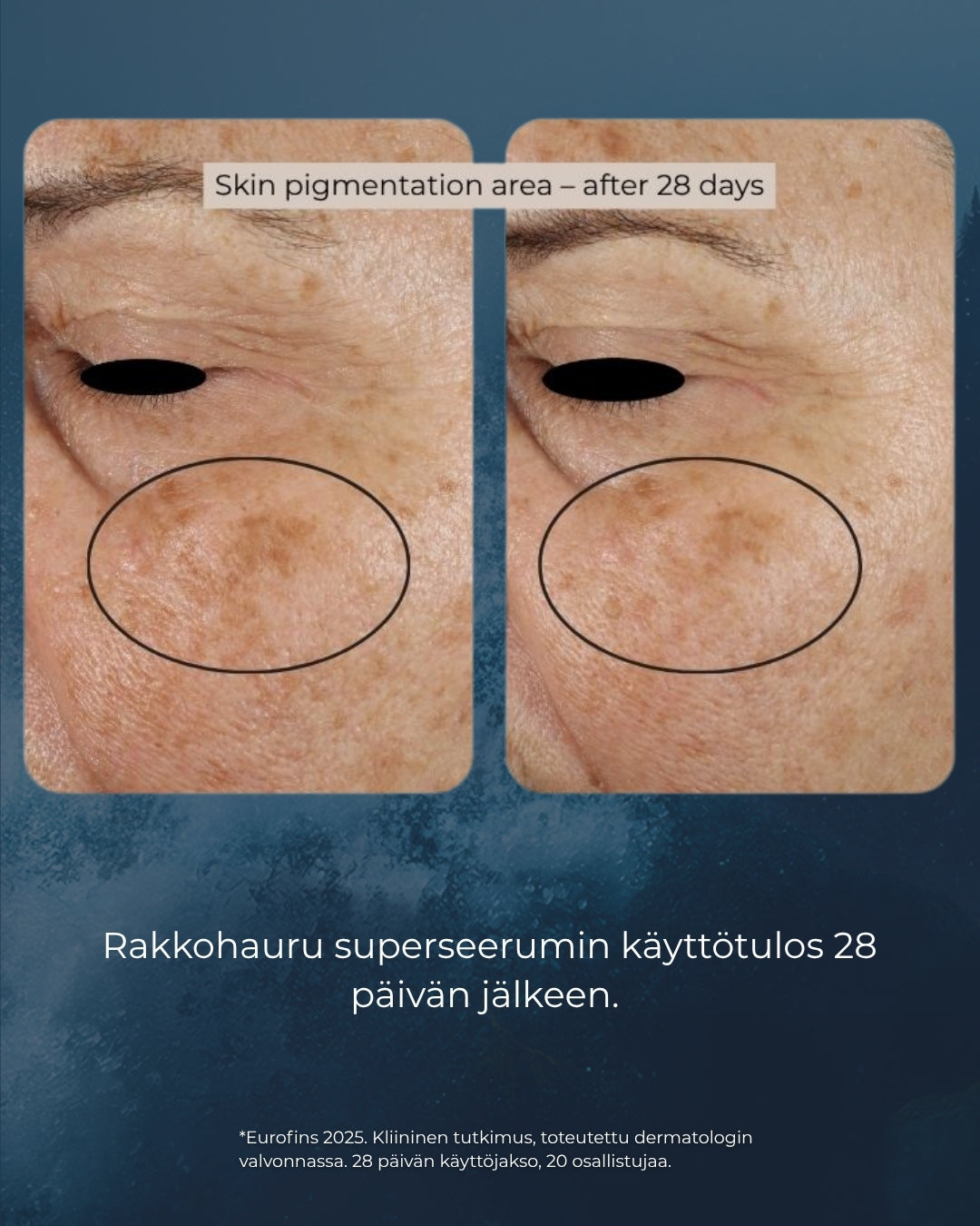 Bladderwrack super serum, peptides, retinol, hyaluronic acid, liver spots, wrinkles, pores