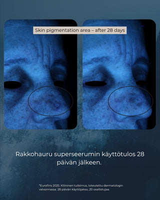 Rakkohauru superseerumi, peptidit, retinoli, hyaluronihappo, maksaläiskät, juonteet, ihohuokoset