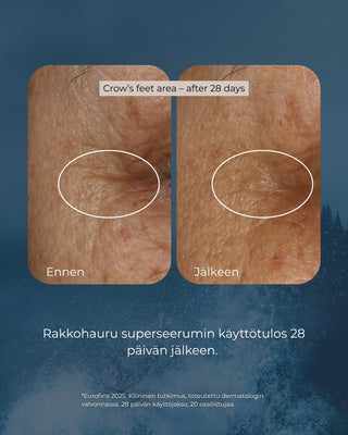 Rakkohauru superseerumi, peptidit, retinoli, hyaluronihappo, maksaläiskät, juonteet, ihohuokoset