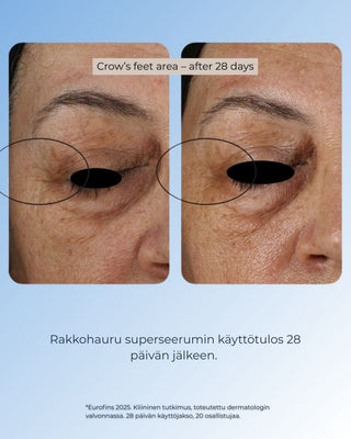 Rakkohauru superseerumi, peptidit, retinoli, hyaluronihappo, maksaläiskät, juonteet, ihohuokoset