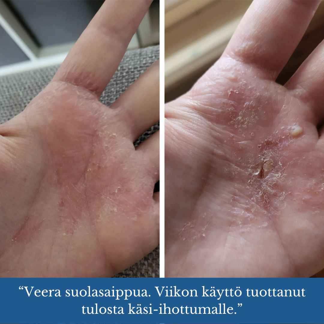 Veera Salt Soap®, lämplig för t.ex. för utslag, akne och psoriasis hud, återfuktar och lugnar huden - Saaren Taika 🇫🇮