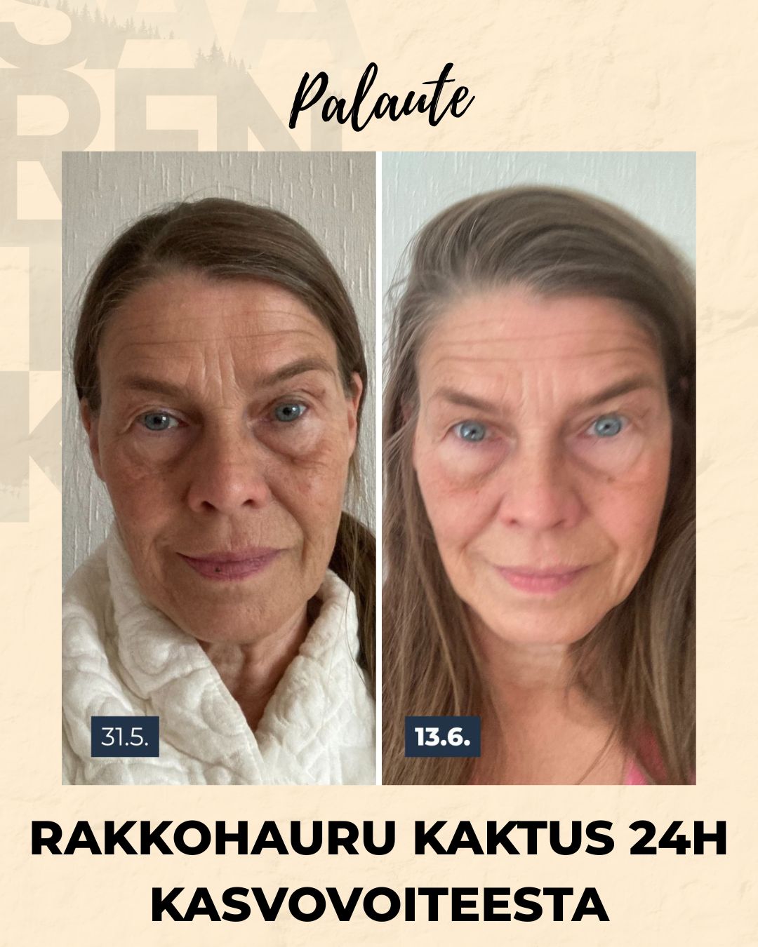 Rakkohauru & Kaktus 24H Prebioottinen Kasvovoide Herkälle Iholle Kasvovoide Saaren Taika