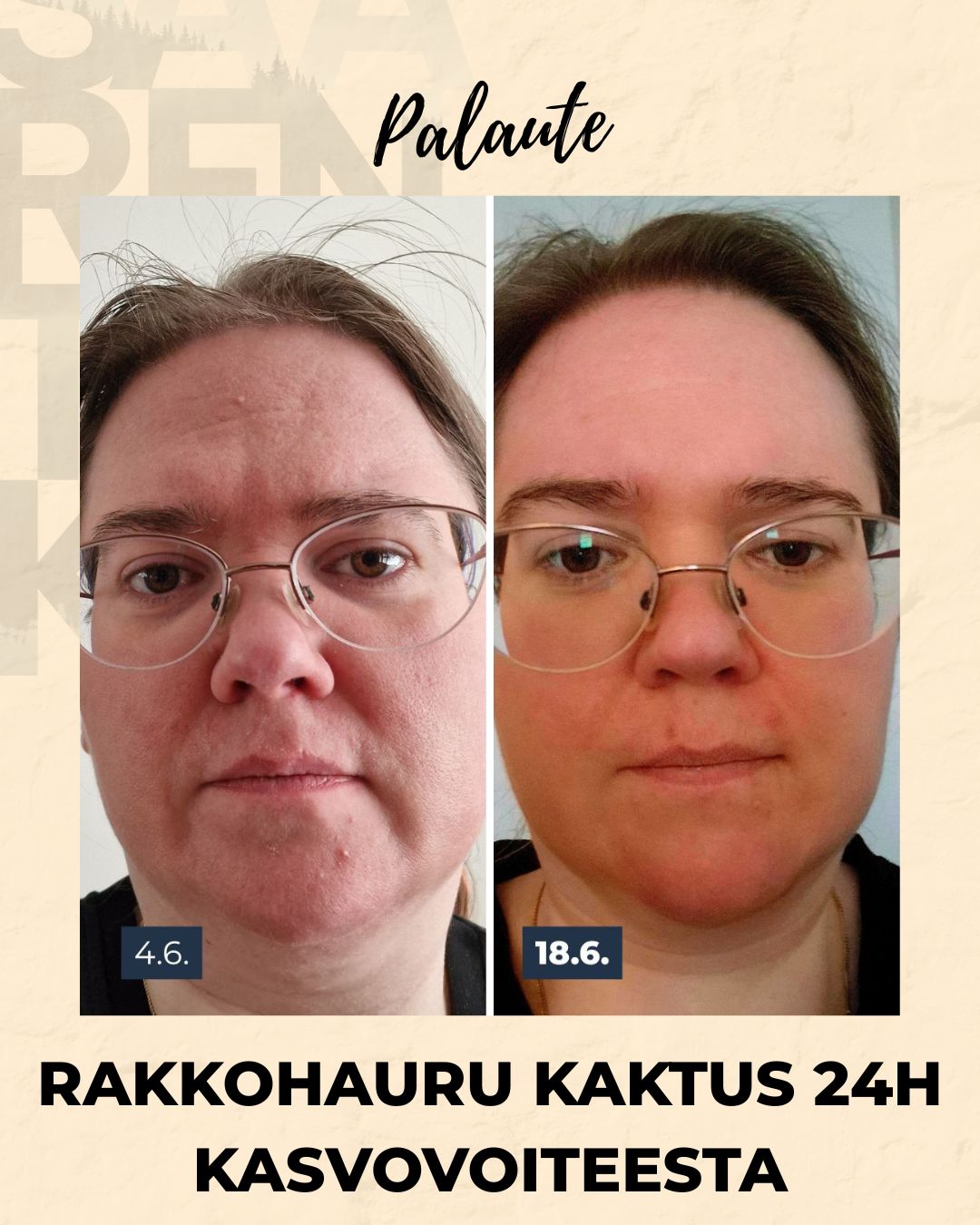 Rakkohauru & Kaktus 24H Prebioottinen Kasvovoide Herkälle Iholle Kasvovoide Saaren Taika